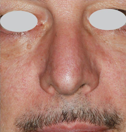 4 2